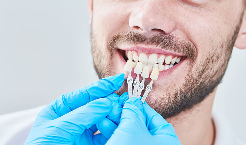 Dentist testing different shades of white against a client's teeth in cosmetic dentistry