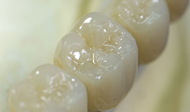 A closeup image of White fillings