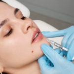 undergoing facial fillers treatment