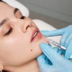 undergoing facial fillers treatment
