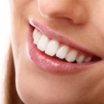 Professional Teeth Whitening treatment in Chichester, UK