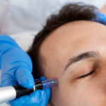 Vampire facial Chichester